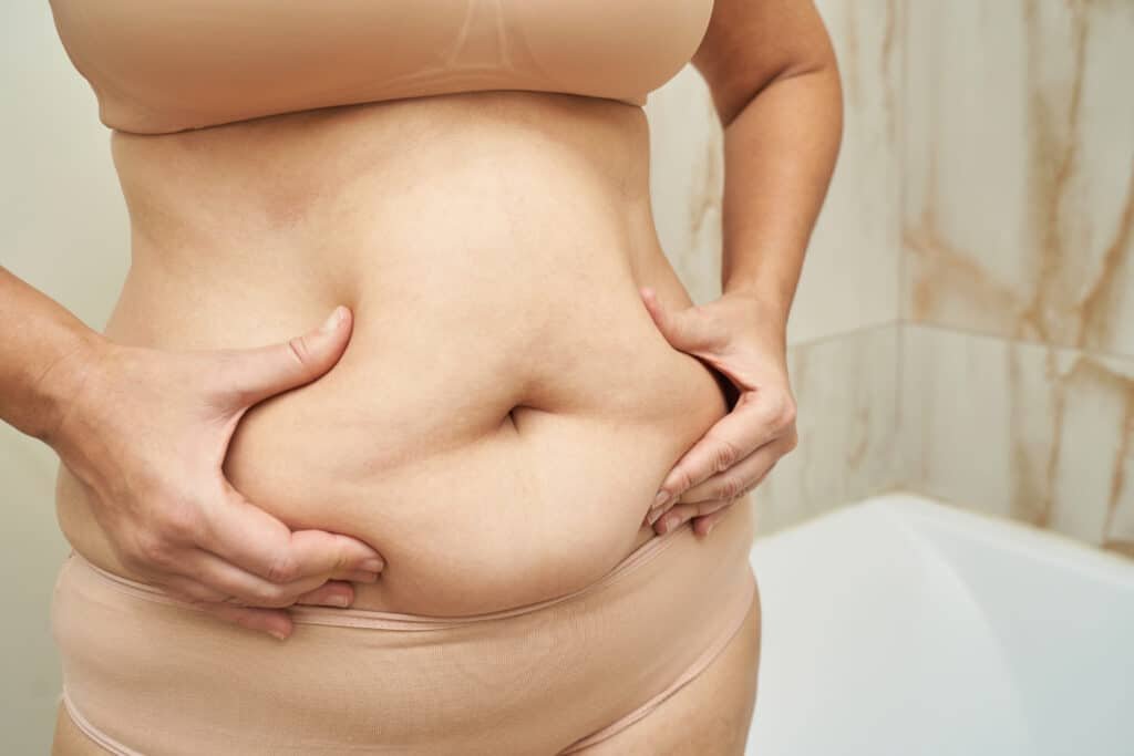Abdominal lift and tummy tuck body contouring procedures