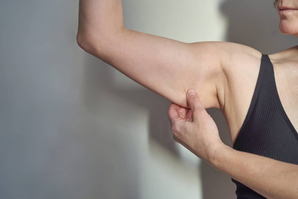 Arm and leg slimming procedures addressing localized fat and sagging skin.