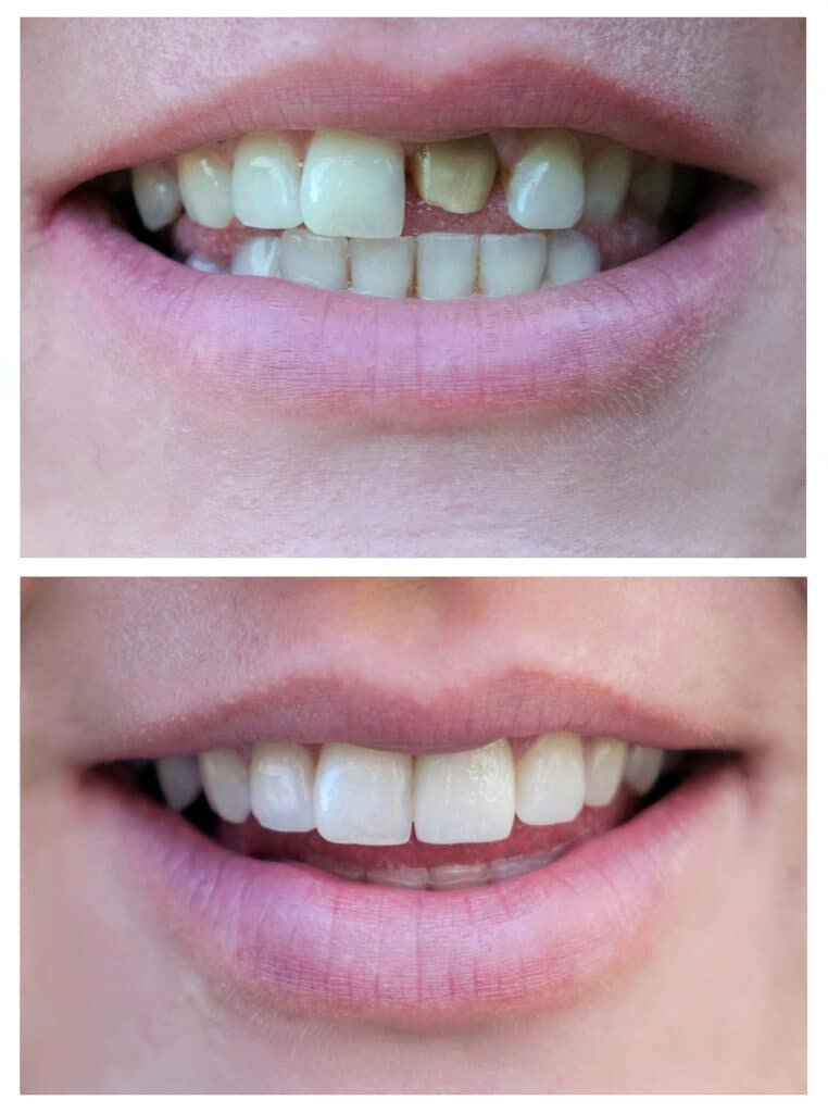 Dental care and aesthetic dentistry options in Turkey