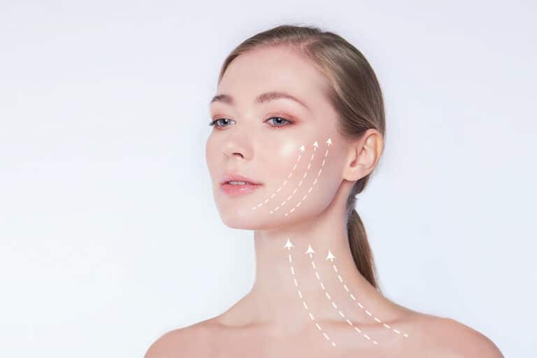 Incisionless face lift and V lift techniques for non-surgical face sculpting.