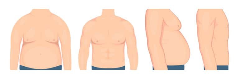 male-body-fat-loss-contouring-turkey