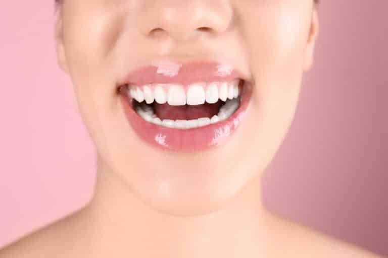 Porcelain crown dental restoration for natural strength and esthetics