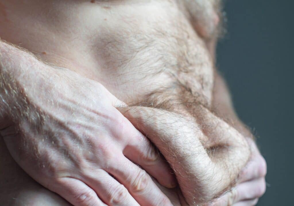 Post‑weight loss body treatments addressing excess skin and skin laxity in men