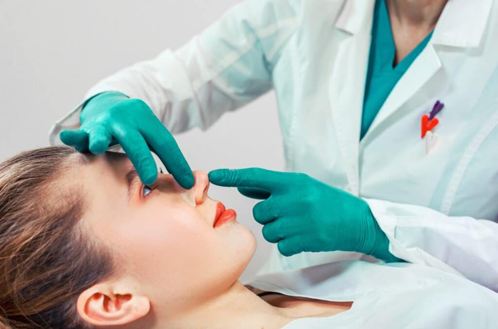Rhinoplasty after fracture addressing functional and aesthetic concerns.