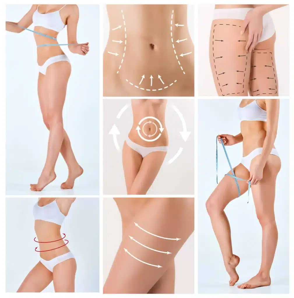 Weight Loss Turkey Body Types