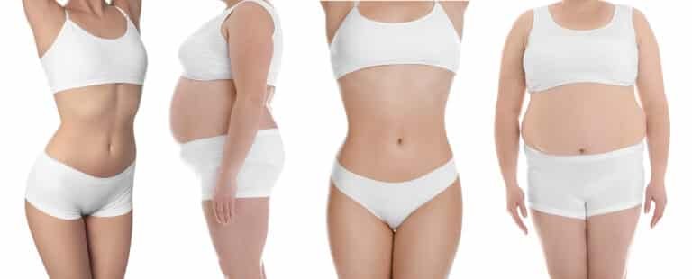 Liposuction for localized fat deposits and body contouring